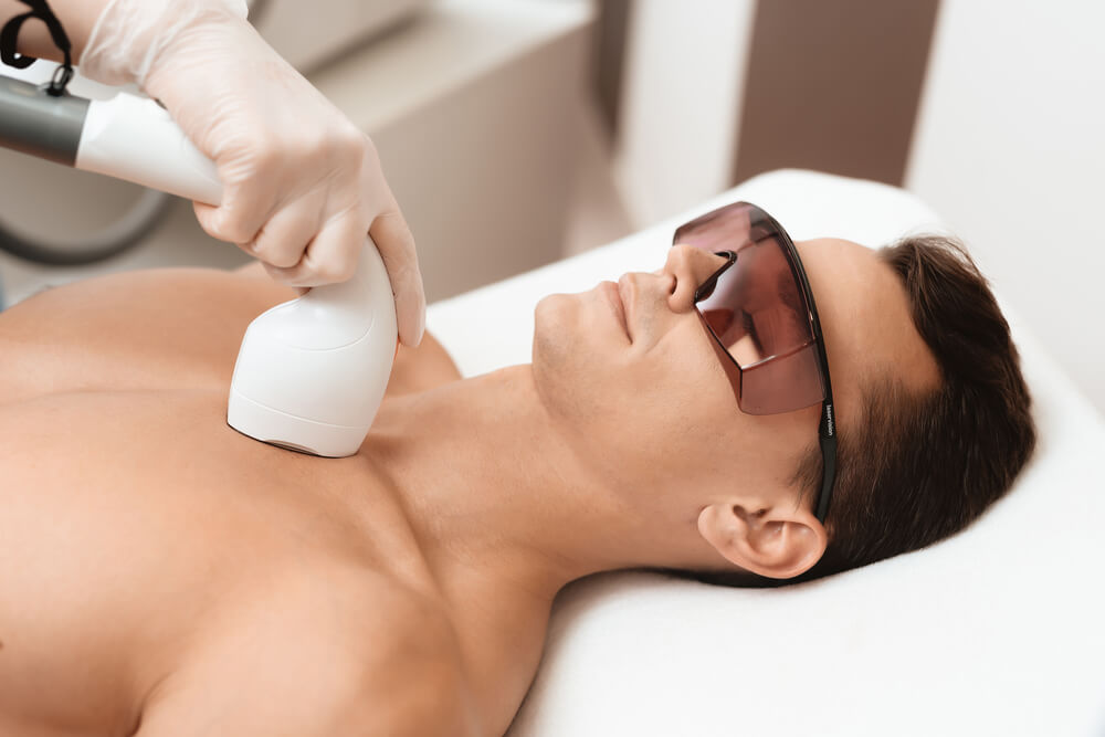 man came to the procedure of laser hair removal