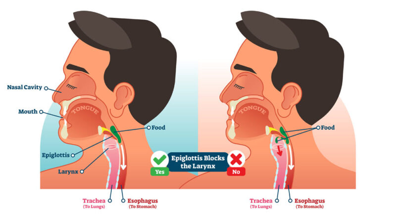 Throat, Swallowing and Voice Disorders | Annapolis and Severna Park, MD