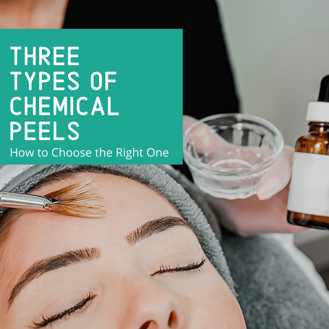 Three Types of Chemical Peels