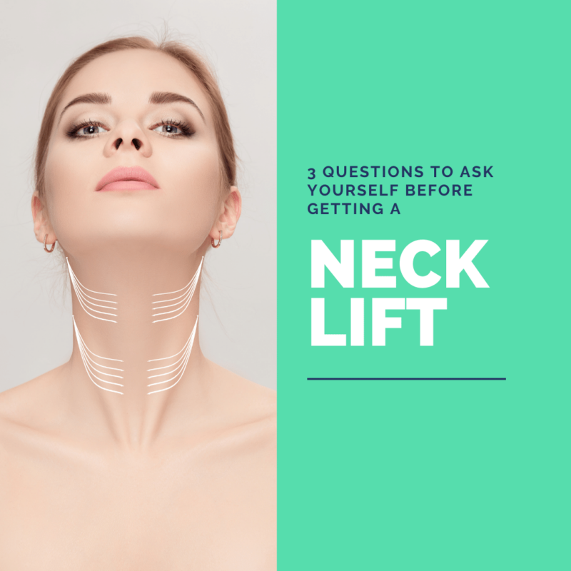 3 Questions to Ask Yourself Before Getting a neck lift