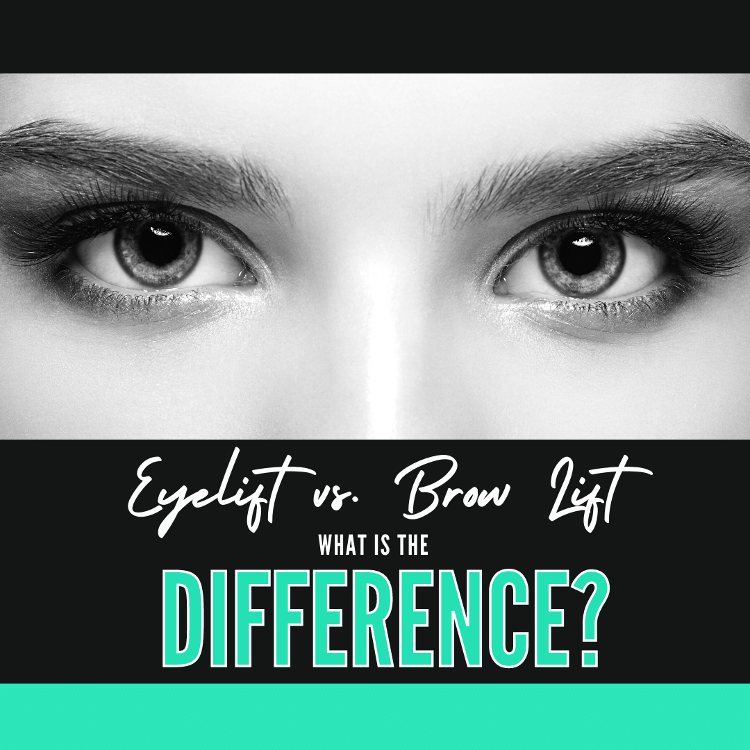Eyelift vs. Brow Lift