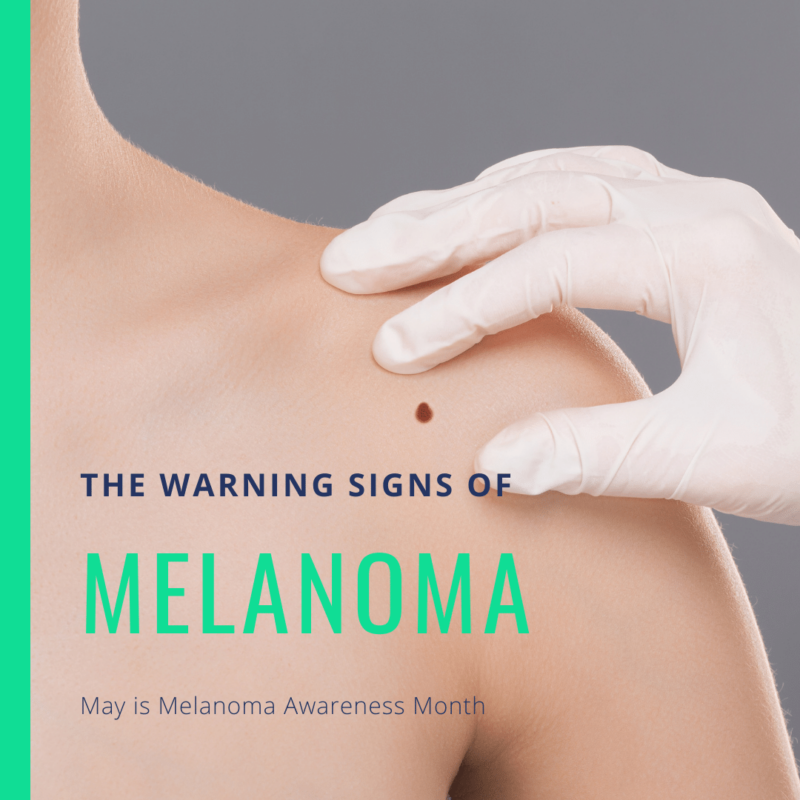 The Warning Signs of Melanoma