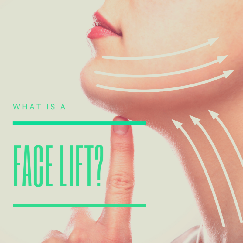 What is a facelift