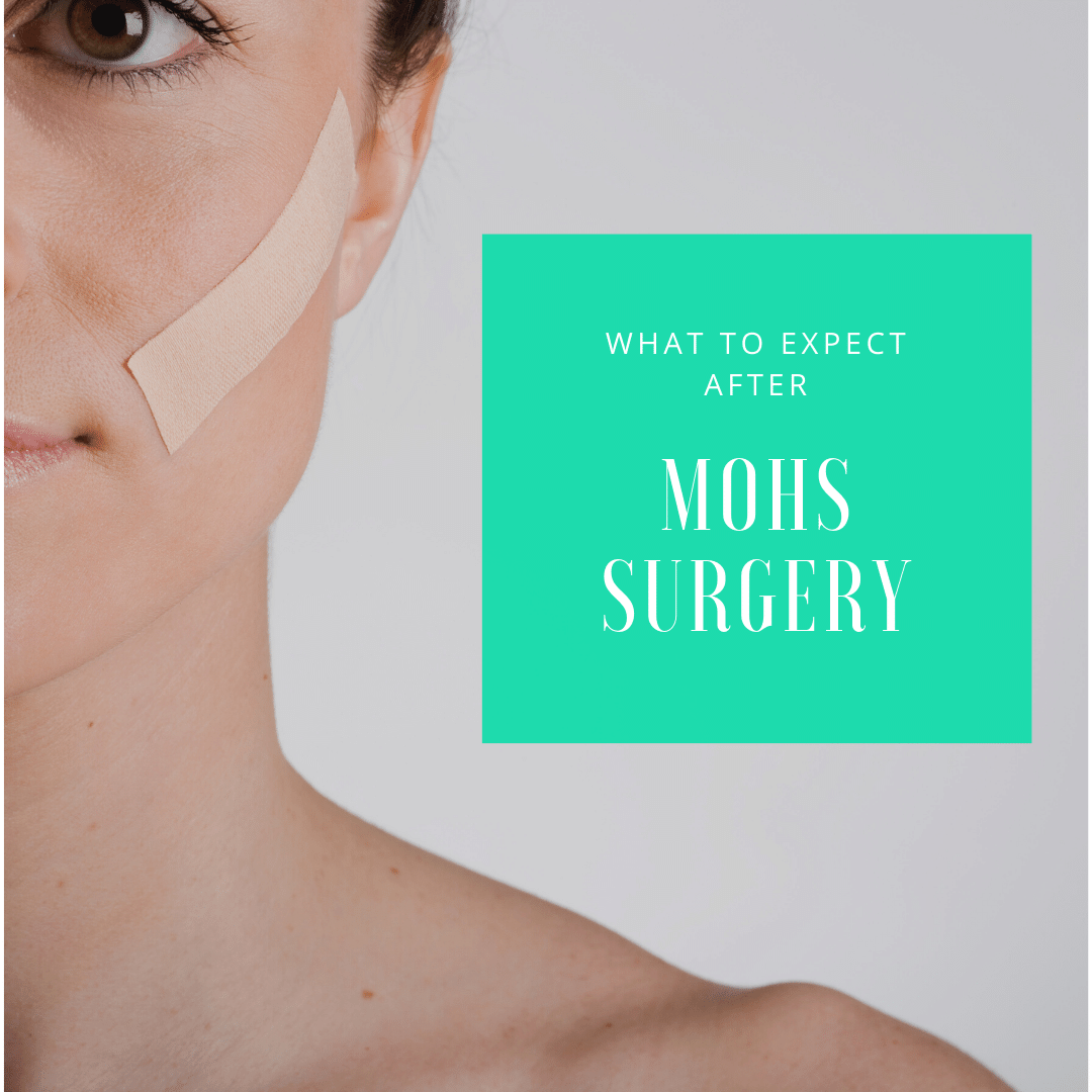 What to Expect After Mohs Surgery