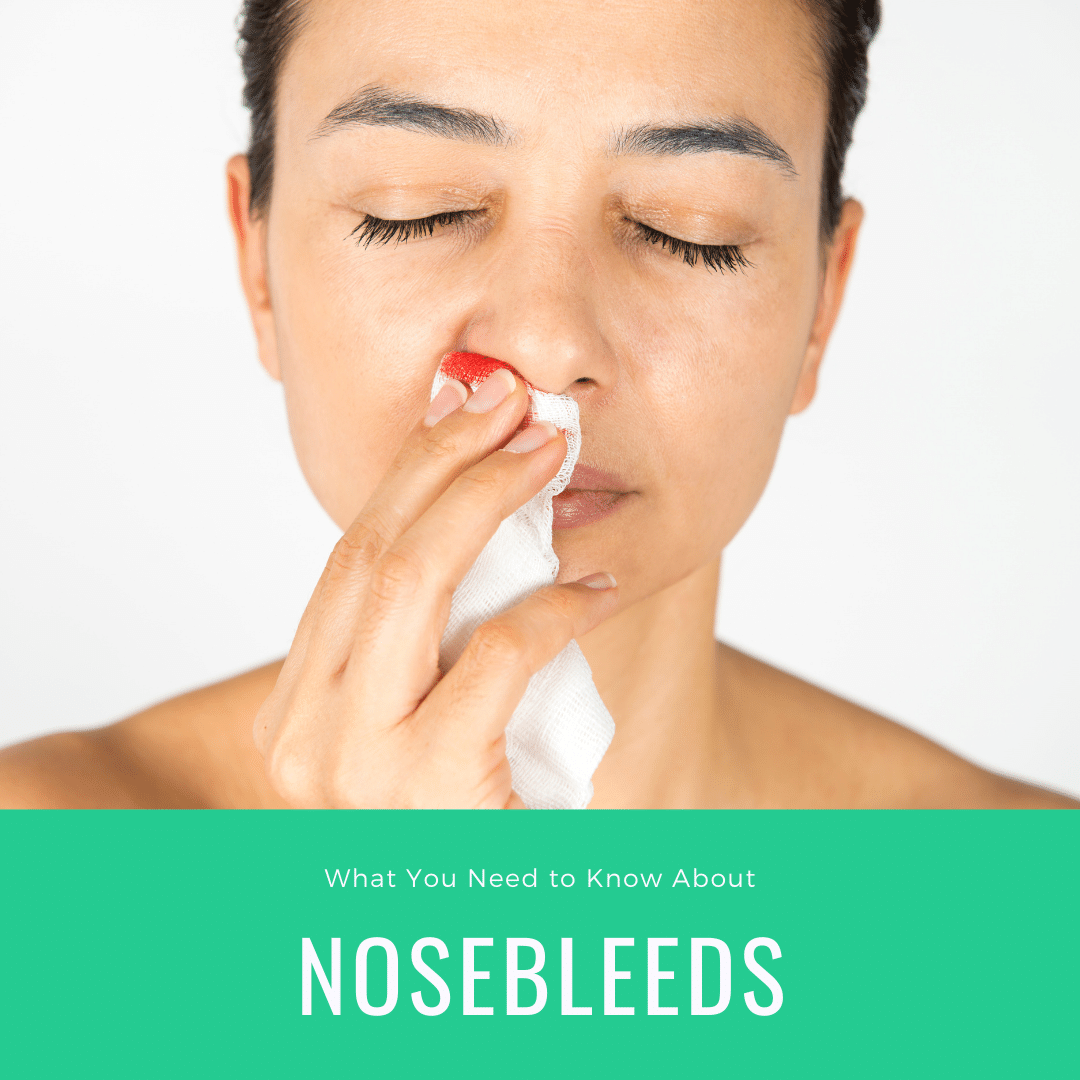 What You Need to Know About Nosebleeds