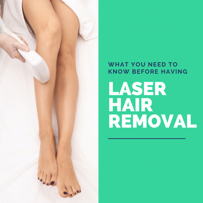 What You Need to Know Before Having Laser Hair Removal