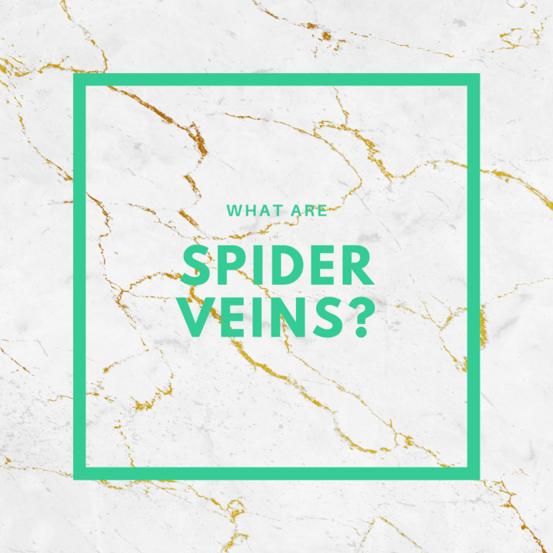 What are Spider Veins