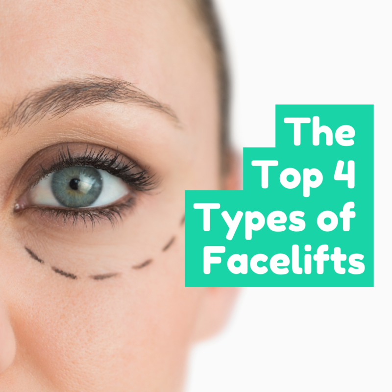 The Top 4 Types of Facelifts