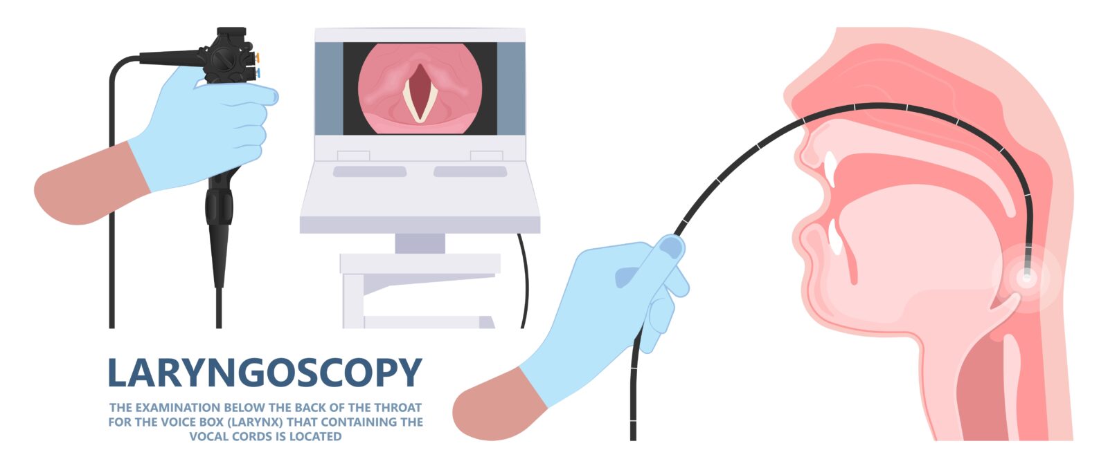 laryngoscopy method